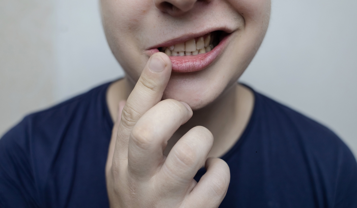 Understanding Facial Nerve Palsy – Causes, Symptoms, and Treatment